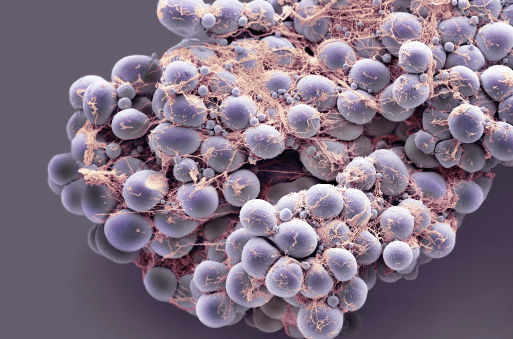 মাদাগাস্কারের জীববৈচিত্র্যর ভূতাত্ত্বিক কারণ