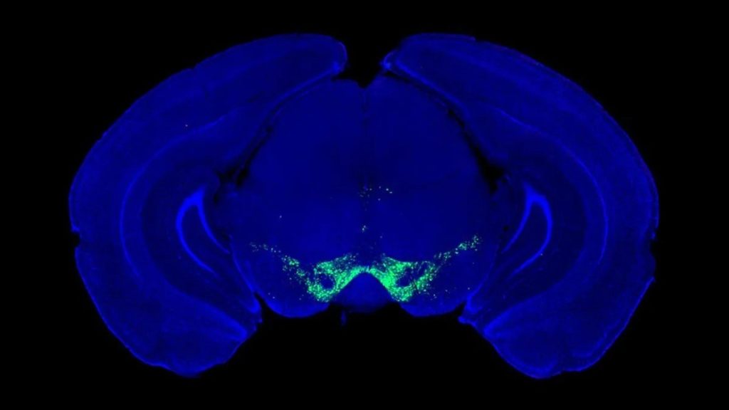 পারকিনসন চিকিৎসা ও ডোপামিন গবেষণা