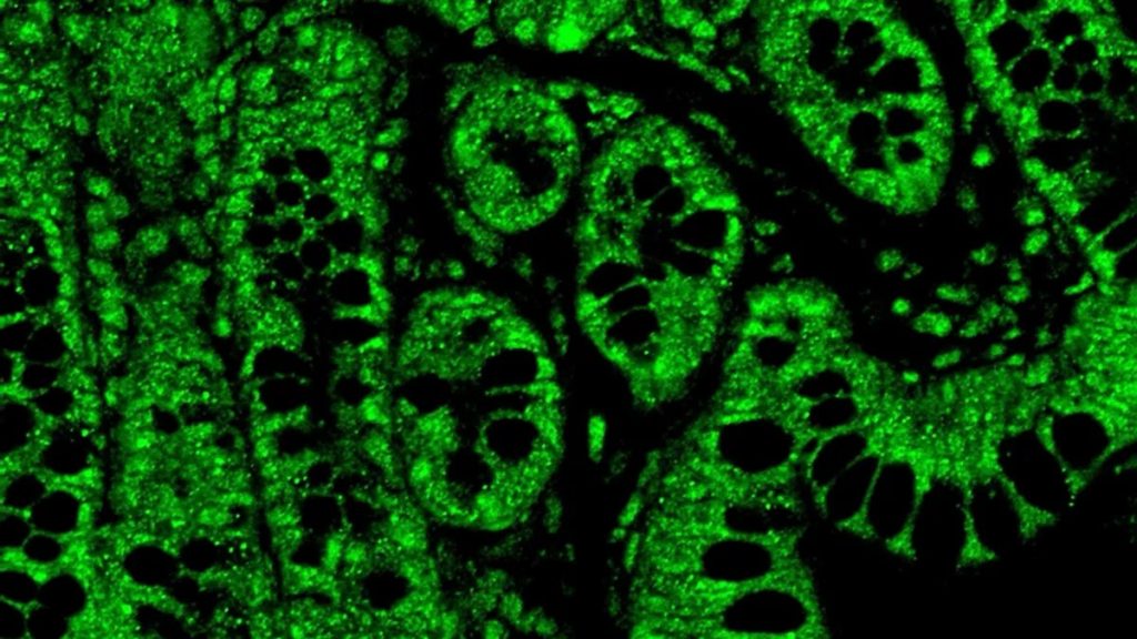 এইচআইভি চিকিৎসায় নেশার উপকরণ? 