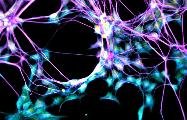 বার্ধক্যেও সতেজ স্মৃতি